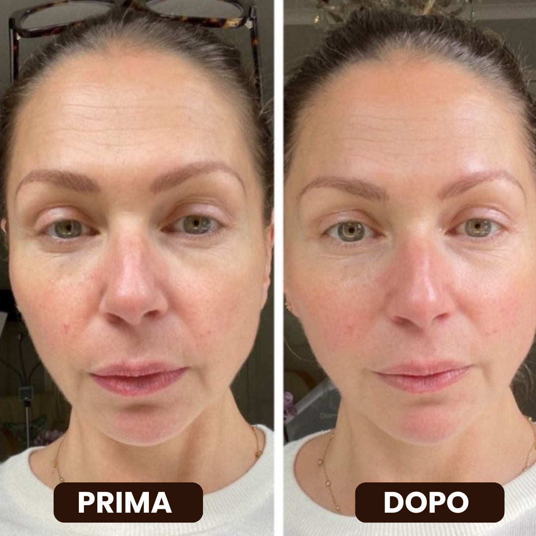 Neora - Spazzola Drenaggio Linfatico